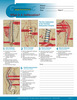 What Is A Subluxation?